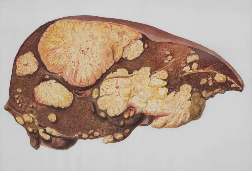 Liver